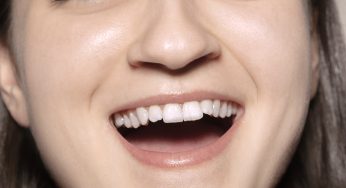 顔のたるみを改善！かんたん表情筋トレーニング